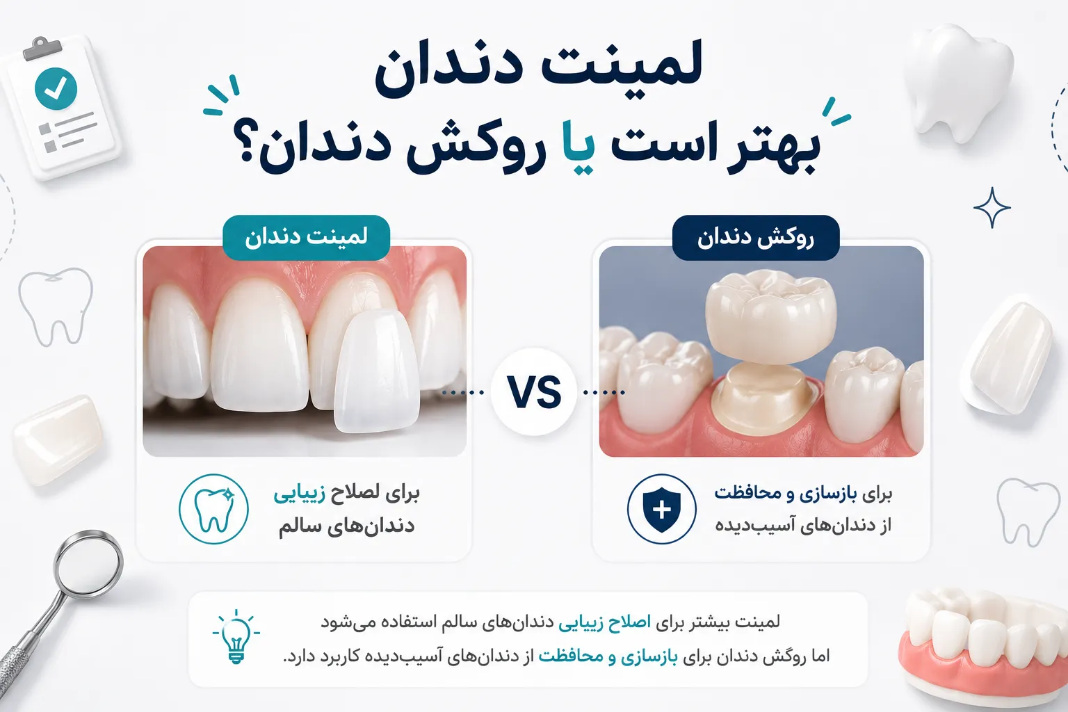 لمینت یا روکش دندان کدام انتخاب بهتری است؟ 