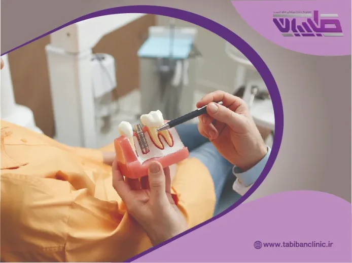 مشکلات طولانیمدت کاشت دندان و راهکارهای پیشگیری
